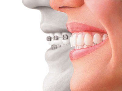 The image features two side-by-side photos  one showing a person s teeth and gums, and another showing a smiling mouth with visible braces.