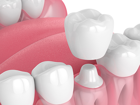 The image shows a collection of artificial teeth with varying shades and shapes, possibly for dental implants or prosthetics, presented against a red background with a watermark that reads Tutorial 2019.