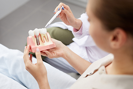 Woman holding a pink toothbrush with dental implants on it while sitting in a dentist s chair.