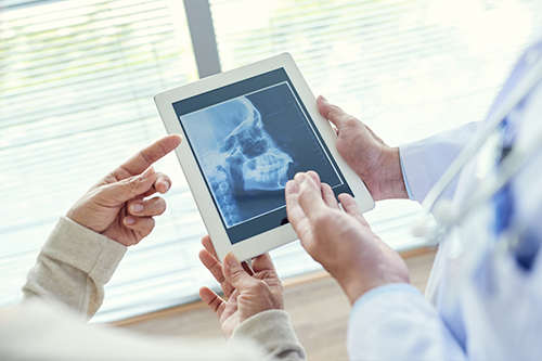 A tablet screen displaying an X-ray image being held by a person, with another person holding the tablet while a third person, possibly a medical professional, points at the X-ray.