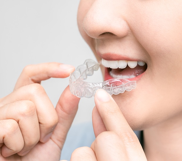 Pearl City Clear Aligners
