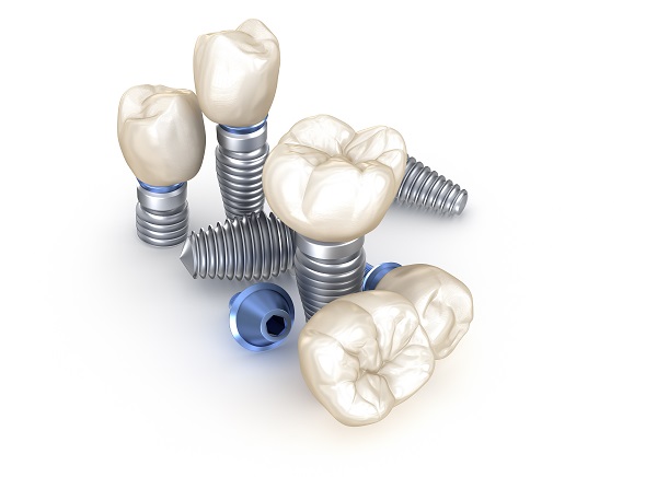 Dental Implant Restoration Pearl City, HI