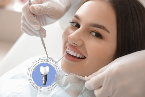 Avoiding Infection With Dental Implants