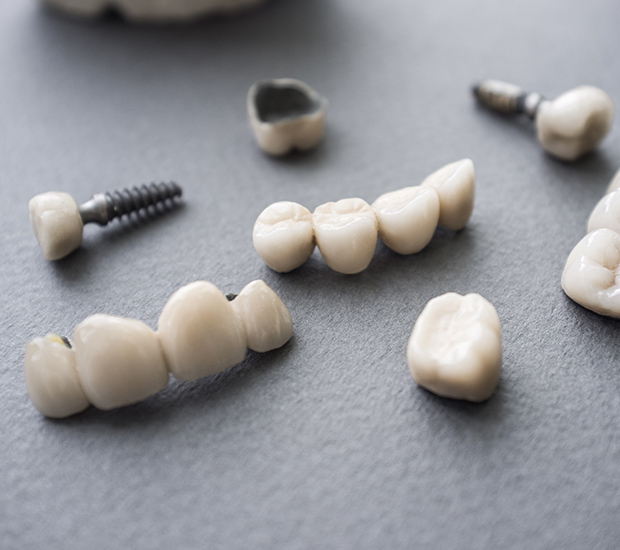 Pearl City The Difference Between Dental Implants and Mini Dental Implants