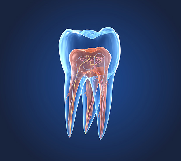 Pearl City What is an Endodontist
